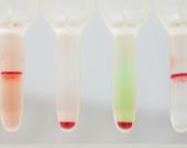 Video: L'agglutinazione
