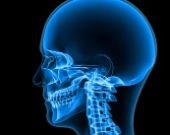 Video: Il cranio