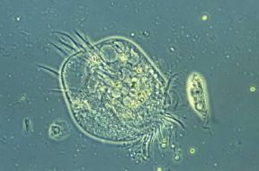 Protozoi. Un ciliato appartenente al genere Euplotes.De Agostini Picture Library Protozoi. Un ciliato appartenente al genere Euplotes.De Agostini Picture Library