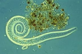 Nematodi . Microscopico nematodo di acque interstiziali salmastre.De Agostini Picture Library / S. Giacomelli Nematodi . Microscopico nematodo di acque interstiziali salmastre.De Agostini Picture Library / S. Giacomelli