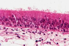 Mucosa. Microfotografia della mucosa della faringe.De Agostini Picture Library Mucosa. Microfotografia della mucosa della faringe.De Agostini Picture Library