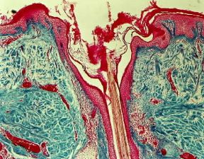 Cute. Sezione al microscopio di cute con pelo.De Agostini Picture Library / E. Giovenzana