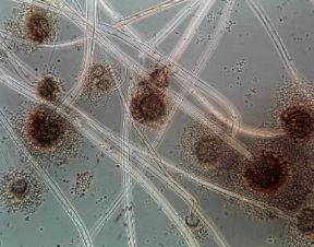 Fungo. Esemplare di Aspergillus niger in una microfotografia.De Agostini Picture Library/E. Giovenzana Fungo. Esemplare di Aspergillus niger in una microfotografia.De Agostini Picture Library/E. Giovenzana