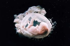 Amnio. Embrione umano, dentro il sacco amniotico, alla nona settimana di vita intrauterina.De Agostini Picture Library/L: Ricciarini Amnio. Embrione umano, dentro il sacco amniotico, alla nona settimana di vita intrauterina.De Agostini Picture Library/L: Ricciarini