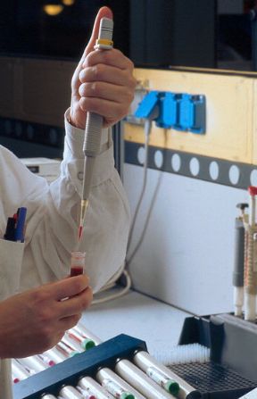 Le analisi del sangue. Analisi cliniche. Le analisi cliniche, effettuate su campioni di sangue prelevati al paziente, costituiscono una componente essenziale degli esami di laboratorio. Grazie a esse è possibile controllare i parametri ematochimici, che forniscono indicazioni preziose sullo stato di salute o di malattia della persona. Le analisi del sangue. Analisi cliniche. Le analisi cliniche, effettuate su campioni di sangue prelevati al paziente, costituiscono una componente essenziale degli esami di laboratorio. Grazie a esse è possibile controllare i parametri ematochimici, che forniscono indicazioni preziose sullo stato di salute o di malattia della persona.