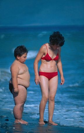 Accumulo di sostanze grasse nell'organismo. Adipe. Nell'uomo l'accumulo di sostanze grasse nei tessuti è variabile e legato a diversi fattori quali l'età, il sesso, la razza, il tipo di alimentazione, l'ereditarietà. Accumulo di sostanze grasse nell'organismo. Adipe. Nell'uomo l'accumulo di sostanze grasse nei tessuti è variabile e legato a diversi fattori quali l'età, il sesso, la razza, il tipo di alimentazione, l'ereditarietà.