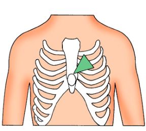 Massaggio cardiaco: il punto di compressione. Rianimazione cardiopolmonare. Punto di compressione per il massaggio cardiaco. Massaggio cardiaco: il punto di compressione. Rianimazione cardiopolmonare. Punto di compressione per il massaggio cardiaco.