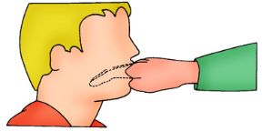 Come stimolare il vomito. Avvelenamento da funghi. Stimolazione al vomito con le dita. Come stimolare il vomito. Avvelenamento da funghi. Stimolazione al vomito con le dita.