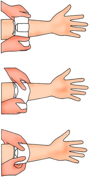 Intervento in caso di emorragia. Compressione con un tampone. Emorragia. In caso di fuoriusciuta di sangue arterioso o venoso da lesioni, bisogna cercare di controllare la perdita ematica comprimendo la ferita con un tampone, una garza ben aderente o un fazzoletto. Intervento in caso di emorragia. Compressione con un tampone. Emorragia. In caso di fuoriusciuta di sangue arterioso o venoso da lesioni, bisogna cercare di controllare la perdita ematica comprimendo la ferita con un tampone, una garza ben aderente o un fazzoletto.