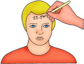 Annotazione dell'ora di applicazione del laccio emostatico. La compressione arteriosa. L’ora esatta di applicazione del laccio va sempre annotata. Annotazione dell'ora di applicazione del laccio emostatico. La compressione arteriosa. L’ora esatta di applicazione del laccio va sempre annotata.