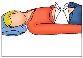 Intervento sulla ferita all'addome: fissate la medicazione. Ferite all'addome. La medicazione va fissata con una fasciatura. Intervento sulla ferita all'addome: fissate la medicazione. Ferite all'addome. La medicazione va fissata con una fasciatura.