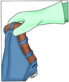 Intervento in caso di ustione da caustici. Rimozione degli indumenti. Ustioni da custici. Preoccupatevi di togliere gli indumenti contaminate dalle sostanze tossiche, proteggendo le mani con guanti di gomma. Intervento in caso di ustione da caustici. Rimozione degli indumenti. Ustioni da custici. Preoccupatevi di togliere gli indumenti contaminate dalle sostanze tossiche, proteggendo le mani con guanti di gomma.