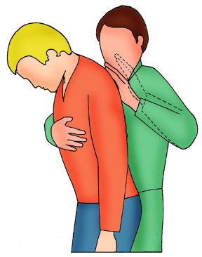 Intervento in caso di ostruzione. Ostruzione. L'ingestione di un corpo estraneo può causare un'ostruzione totale o parziale delle vie respiratorie. Se il soggetto interessato è cosciente, bisogna cercare di farlo tossire percuotendolo col palmo della mano fra le scapole. Intervento in caso di ostruzione. Ostruzione. L'ingestione di un corpo estraneo può causare un'ostruzione totale o parziale delle vie respiratorie. Se il soggetto interessato è cosciente, bisogna cercare di farlo tossire percuotendolo col palmo della mano fra le scapole.