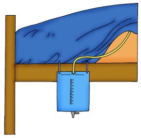Utilizzo del catetere vescicale. Cateterismo vescicale. In caso di forme di incontinenza di grave entità, si può ovviare alla mancanza di controllo sfinterico con l'introduzione di un catetere vescicale. Utilizzo del catetere vescicale. Cateterismo vescicale. In caso di forme di incontinenza di grave entità, si può ovviare alla mancanza di controllo sfinterico con l'introduzione di un catetere vescicale.