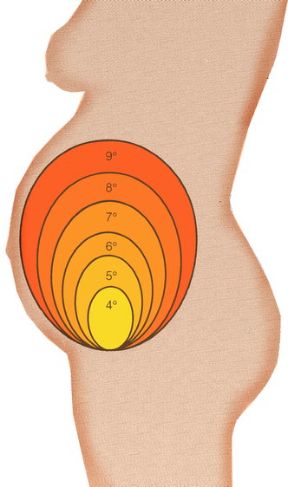 Illustrazione degli stadi della gravidanza. Gravidanza. Con il passare dei mesi di gravidanza la posizione del fondo dell’utero subisce alcune variazioni come illustrato in figura. Illustrazione degli stadi della gravidanza. Gravidanza. Con il passare dei mesi di gravidanza la posizione del fondo dell’utero subisce alcune variazioni come illustrato in figura.