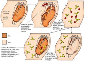 Descrizione della incompatibilità materno-fetale. Incompatibilità materno-fetale. Il controllo del gruppo sanguigno e del fattore Rh prima o durante il concepimento permette di evitare una situazione di incompatibilità materno-fetale. Descrizione della incompatibilità materno-fetale. Incompatibilità materno-fetale. Il controllo del gruppo sanguigno e del fattore Rh prima o durante il concepimento permette di evitare una situazione di incompatibilità materno-fetale.