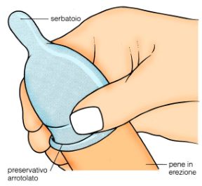 Come utilizzare il profilattico. Profilattico. Durante i rapporti sessuali il profilattico svolge una doppia funzione: può essere utilizzato sia come metodo anticoncezionale, sia come misura preventiva quando si teme il contagio da malattia trasmissibile per via sessuale. Perché il profilattico sia efficace, deve essere srotolato sul pene già eretto prima di iniziare la penetrazione, stringendo il serbatoio tra le dita affinché non si riempia di aria. Va posta attenzione a non lacerare il profilattico con le unghie e a estrarlo trattenendolo alla base del pene ancora eretto, perché non fuoriesca liquido seminale dopo il rapporto. Prima dell'uso i profilattici vanno conservati al riparo da fonti di calore (nel portafoglio si danneggiano), va sempre controllata la loro data di scadenza, riportata sulla confezione e ogni profilattico va utilizzato una volta sola. Come utilizzare il profilattico. Profilattico. Durante i rapporti sessuali il profilattico svolge una doppia funzione: può essere utilizzato sia come metodo anticoncezionale, sia come misura preventiva quando si teme il contagio da malattia trasmissibile per via sessuale. Perché il profilattico sia efficace, deve essere srotolato sul pene già eretto prima di iniziare la penetrazione, stringendo il serbatoio tra le dita affinché non si riempia di aria. Va posta attenzione a non lacerare il profilattico con le unghie e a estrarlo trattenendolo alla base del pene ancora eretto, perché non fuoriesca liquido seminale dopo il rapporto. Prima dell'uso i profilattici vanno conservati al riparo da fonti di calore (nel portafoglio si danneggiano), va sempre controllata la loro data di scadenza, riportata sulla confezione e ogni profilattico va utilizzato una volta sola.