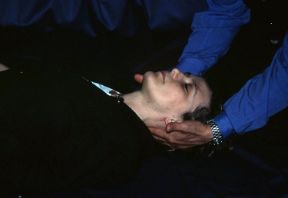 Esame obiettivo: verifica della dolorabilità cervicale. L'esame obiettivo. Applicando una leggerissima pressione con i polpastrelli delle dita si riesce a verificare la presenza di una eventuale dolorabilità della colonna cervicale. Esame obiettivo: verifica della dolorabilità cervicale. L'esame obiettivo. Applicando una leggerissima pressione con i polpastrelli delle dita si riesce a verificare la presenza di una eventuale dolorabilità della colonna cervicale.