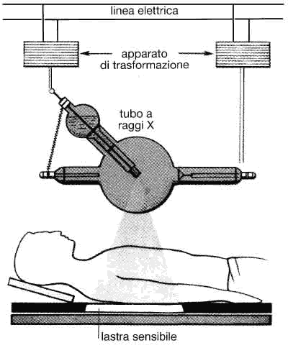 Figura 22.3 Esame radiografico: i raggi X attraversano il corpo e colpiscono la lastra sensibile. Se incontrano strutture capaci di intercettarli, come per esempio le ossa, o corpi estranei, le parti sottostanti della lastra non vengono impressionate e rimangono bianche, mentre le altre appaiono scure. Modulazione di ampiezza Modulazione di frequenza Figura 22.3 Esame radiografico: i raggi X attraversano il corpo e colpiscono la lastra sensibile. Se incontrano strutture capaci di intercettarli, come per esempio le ossa, o corpi estranei, le parti sottostanti della lastra non vengono impressionate e rimangono bianche, mentre le altre appaiono scure. Modulazione di ampiezza Modulazione di frequenza