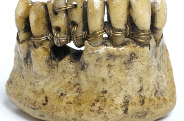 denti-etruschi denti-etruschi